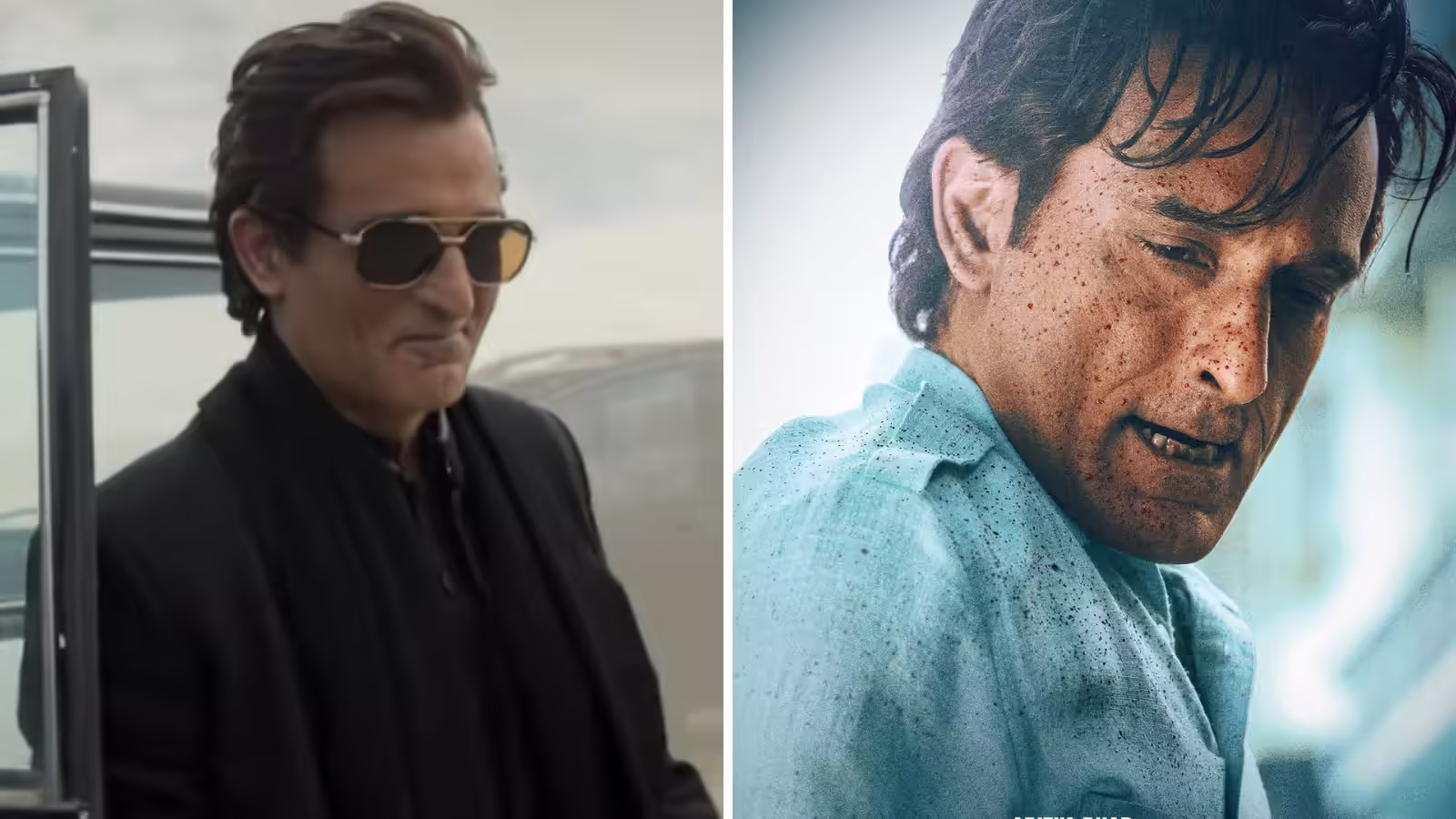 असली नहीं है ‘धुरंधर’ में लहराते अक्षय खन्ना के बाल! जवानी से ही उठाया गंजेपन का बोझ, जानें क्या है समस्या