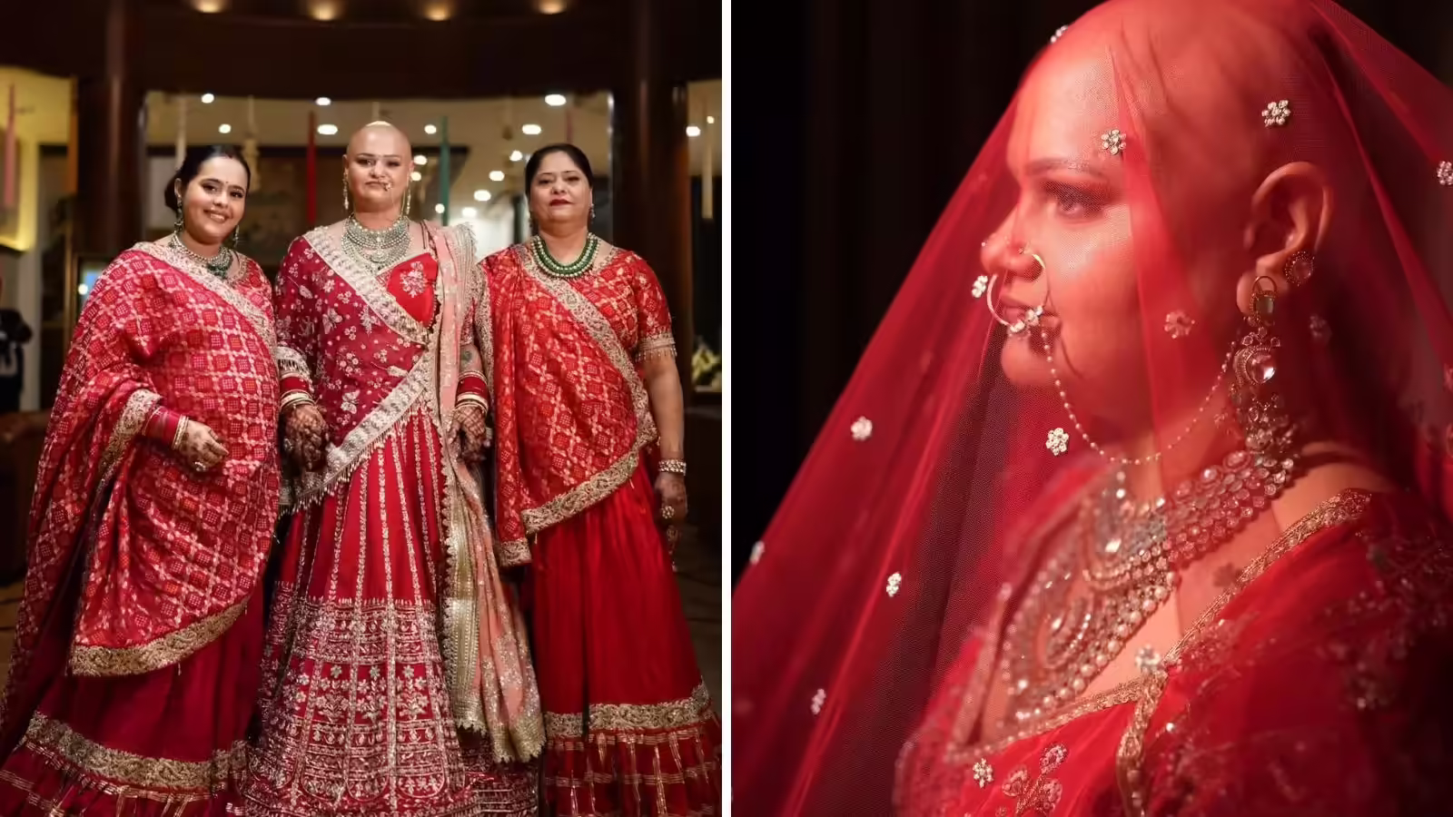 इसे कहते हैं सच्चा प्यार…लड़के की एक सलाह और सिर मुंडाकर दुल्हन बनीं महिमा, शादी ने दिया समाज के मुंह पर तमाचा